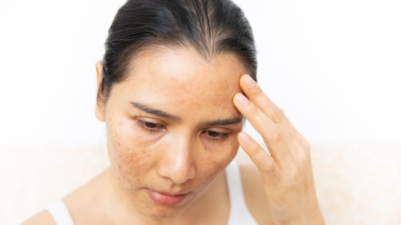 Harsh Skincare Products